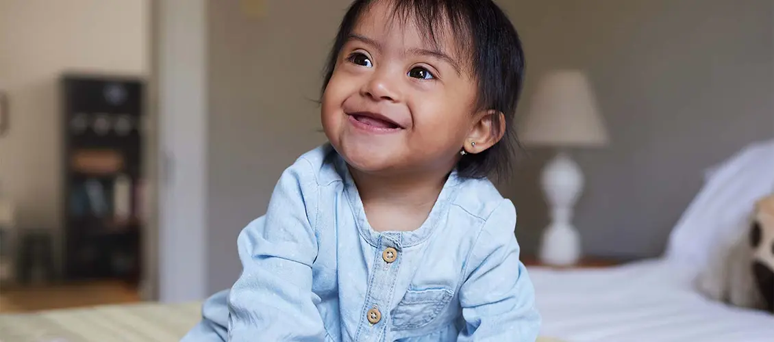 Down Syndrome Therapy Support for Children in Gurgaon
